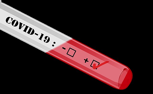 Coronavirus Águilas. ¿Cuantos casos confirmados de infección por COVID19 hay?